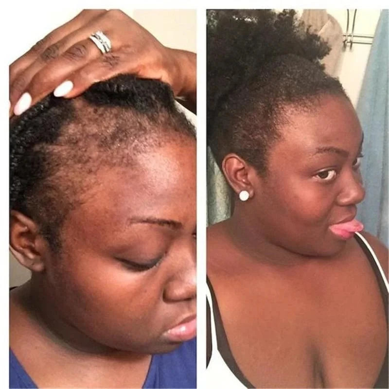 100ML Hair Shampoo For Fast Hair Growth Rosemary Onion Shampoo Spray Anti Hair Loss Effective Within 7 Day Hair Growth Product